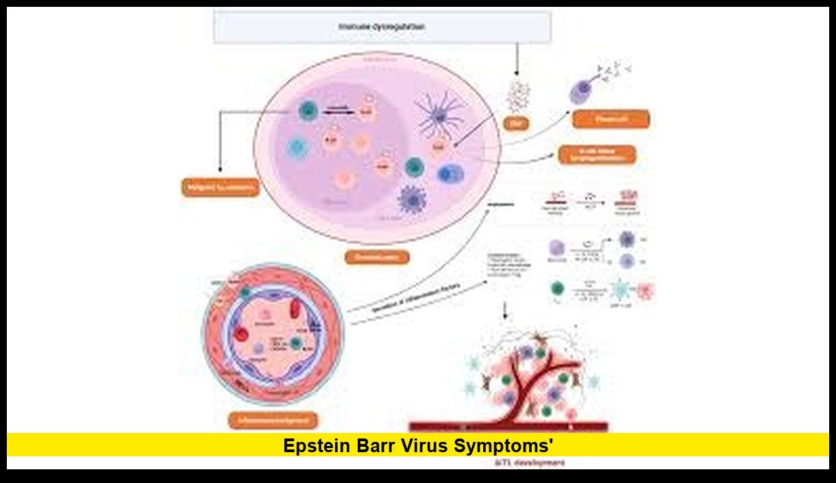 Epstein Barr Virus Symptoms: Latest Medical Insights, Warning Signs, and What Americans Should Know in 2026