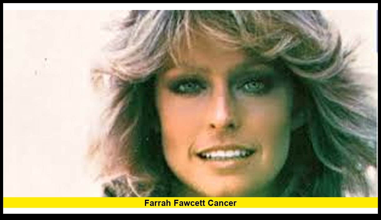 Farrah Fawcett cancer